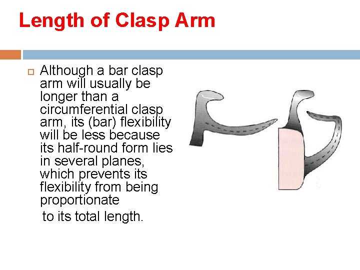 Length of Clasp Arm Although a bar clasp arm will usually be longer than