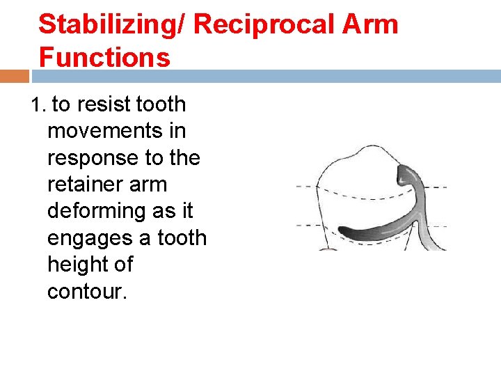 Stabilizing/ Reciprocal Arm Functions 1. to resist tooth movements in response to the retainer