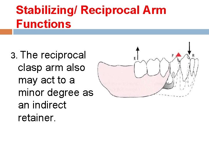 Stabilizing/ Reciprocal Arm Functions 3. The reciprocal clasp arm also may act to a