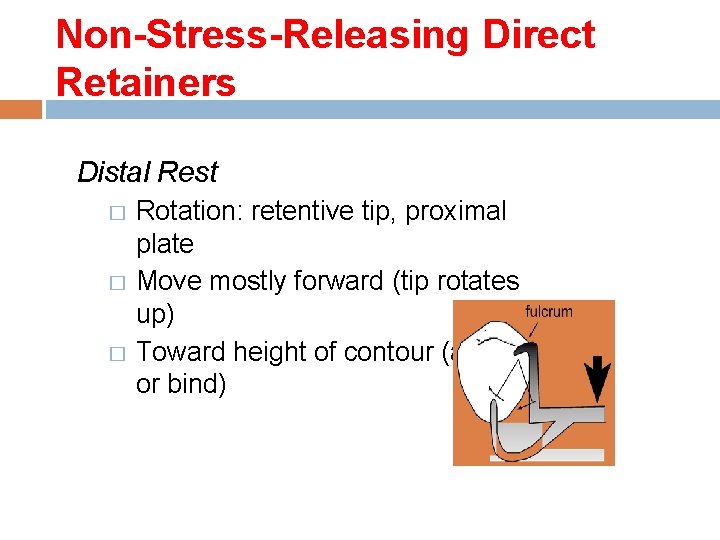 Non-Stress-Releasing Direct Retainers Distal Rest Rotation: retentive tip, proximal plate � Move mostly forward