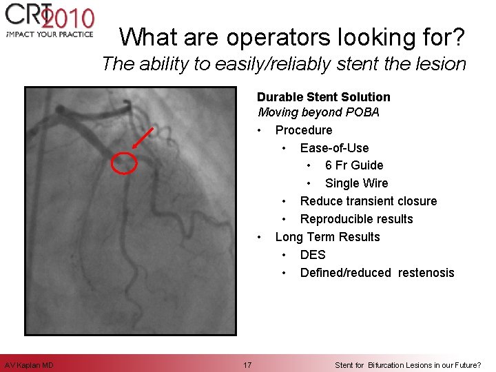What are operators looking for? The ability to easily/reliably stent the lesion Durable Stent