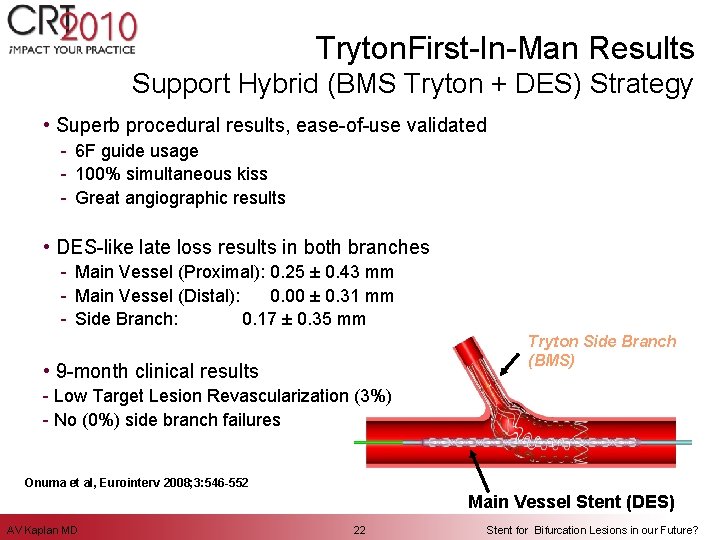 Tryton. First-In-Man Results Support Hybrid (BMS Tryton + DES) Strategy • Superb procedural results,