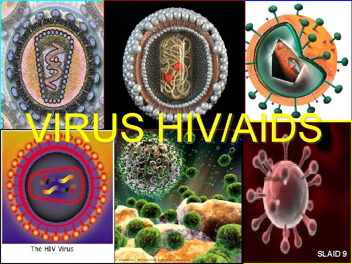 VIRUS HIV/AIDS 9 SLAID 9 