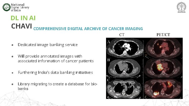DL IN AI CHAVI COMPREHENSIVE DIGITAL ARCHIVE OF CANCER IMAGING ● Dedicated image banking