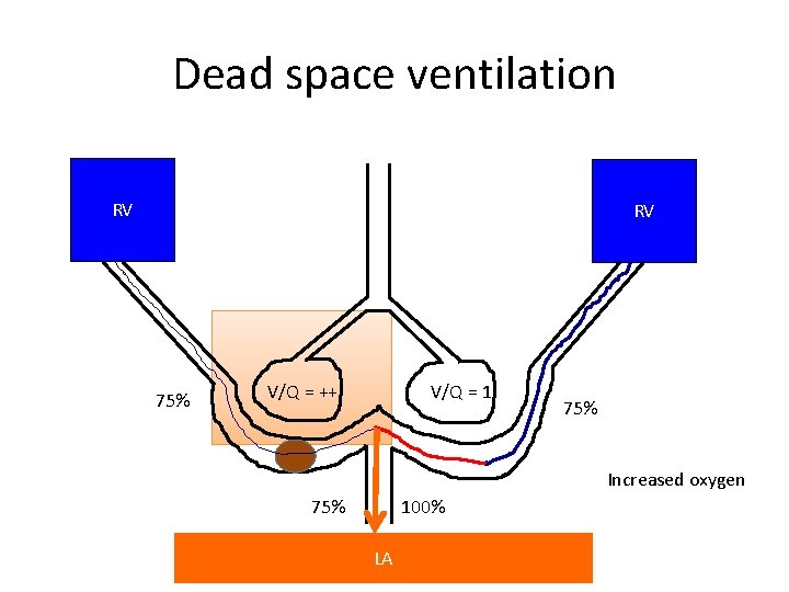 Dead space ventilation RV RV 75% V/Q = ++ V/Q = 1 75% Increased