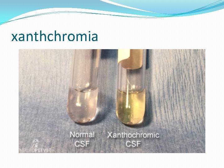 xanthchromia 