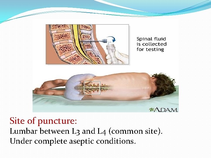 Site of puncture: Lumbar between L 3 and L 4 (common site). Under complete