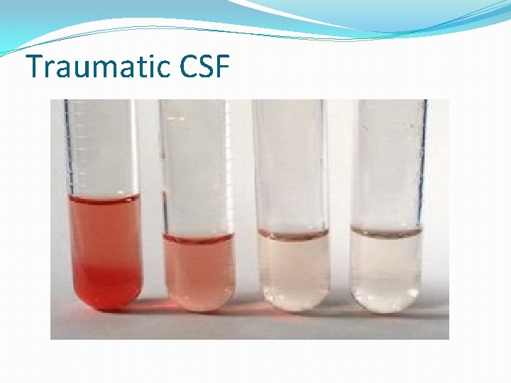 Traumatic CSF 