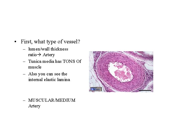  • First, what type of vessel? – lumen/wall thickness ratio Artery – Tunica