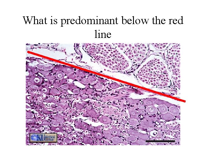 What is predominant below the red line 