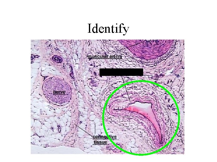 Identify 