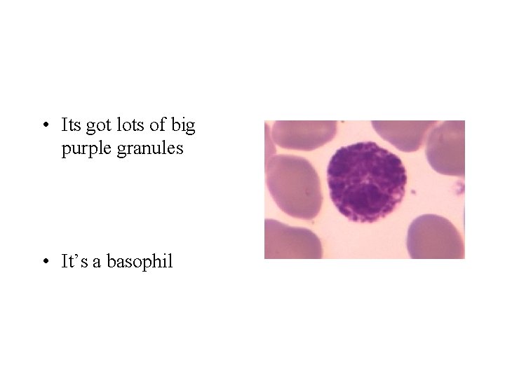  • Its got lots of big purple granules • It’s a basophil 