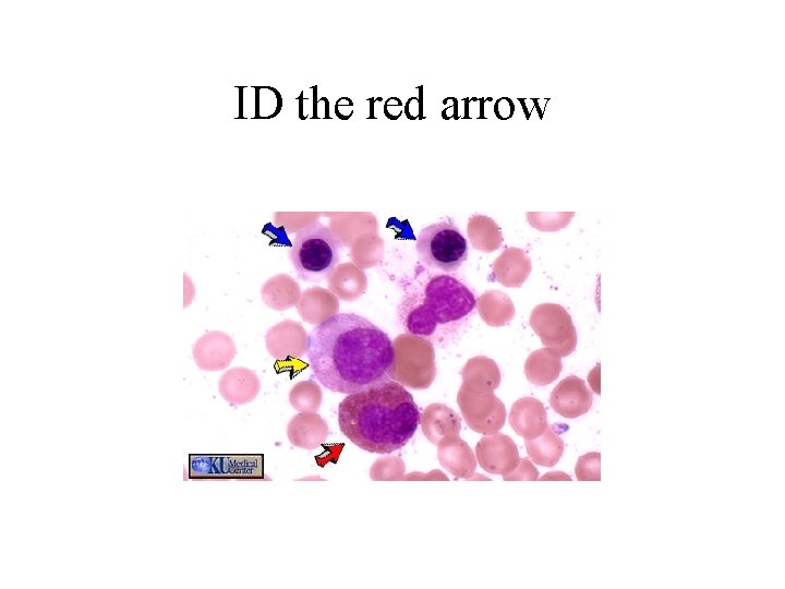 ID the red arrow 