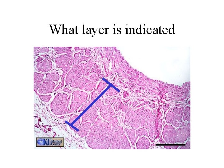 What layer is indicated 