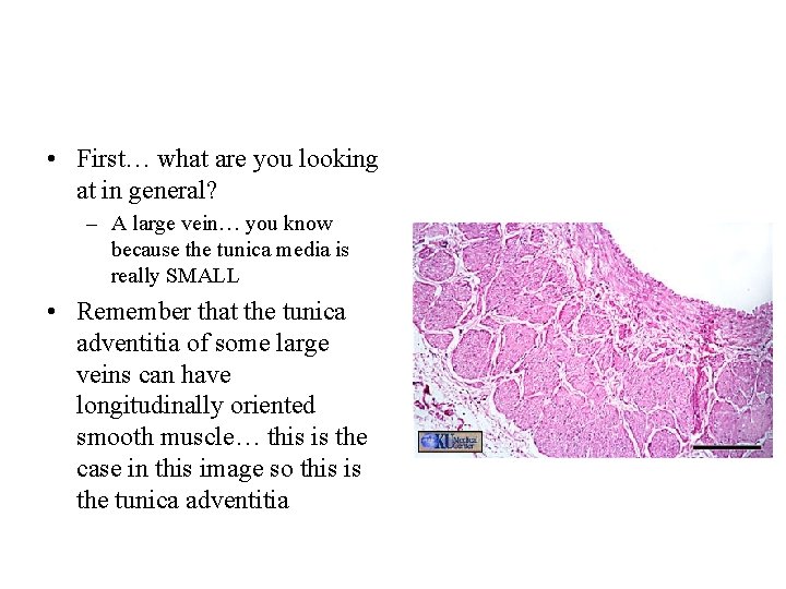  • First… what are you looking at in general? – A large vein…