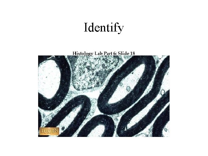 Identify 