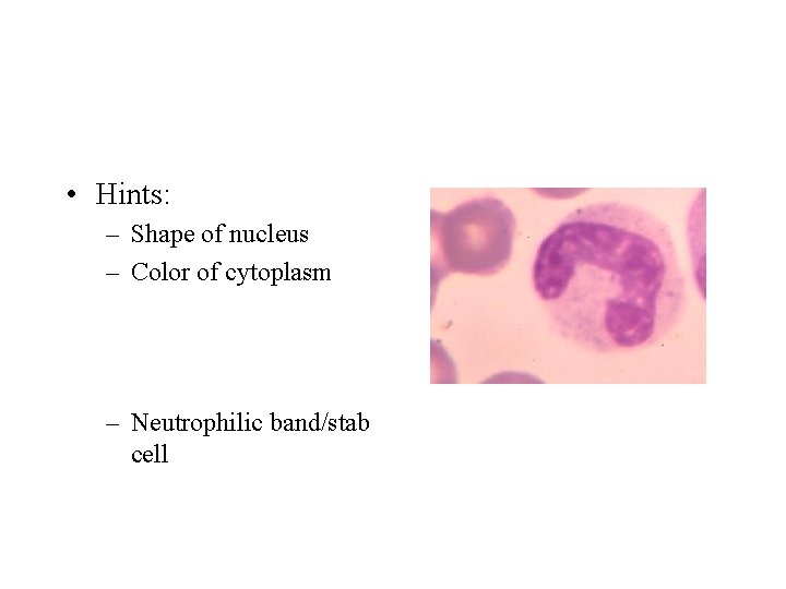 • Hints: – Shape of nucleus – Color of cytoplasm – Neutrophilic band/stab
