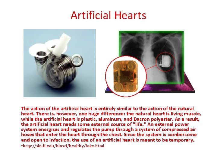 Artificial Hearts The action of the artificial heart is entirely similar to the action Artificial Hearts The action of the artificial heart is entirely similar to the action