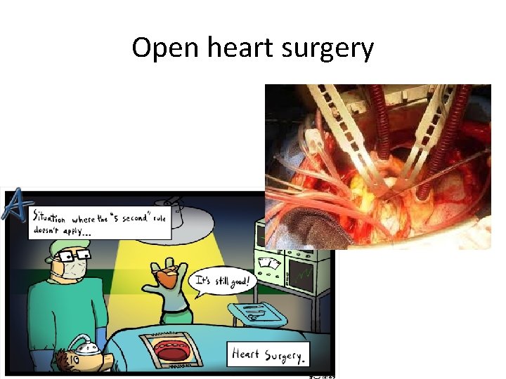 Open heart surgery Open heart surgery