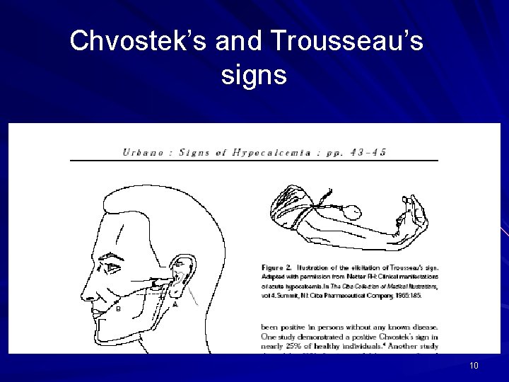 Chvostek’s and Trousseau’s signs 10 