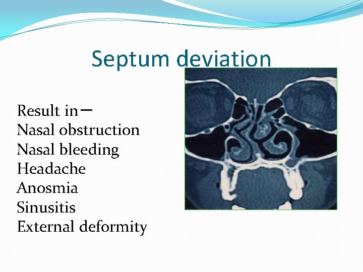 nose-and-paranasal-sinuses-by-dr-adel-sahib