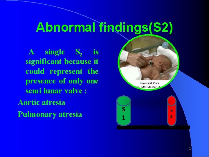 Abnormal findings(S 2) A single S 2 is significant because it could represent the
