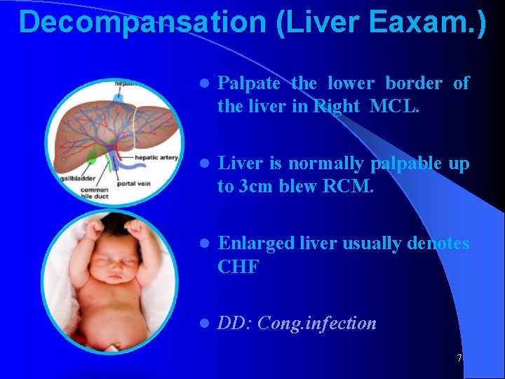 Decompansation (Liver Eaxam. ) l Palpate the lower border of the liver in Right