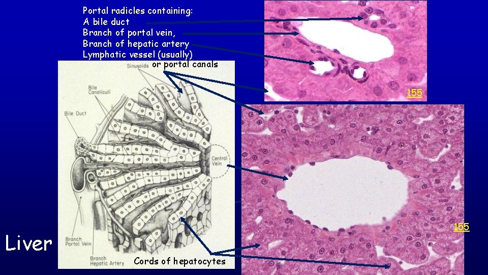 Portal radicles containing: A bile duct Branch of portal vein, Branch of hepatic artery