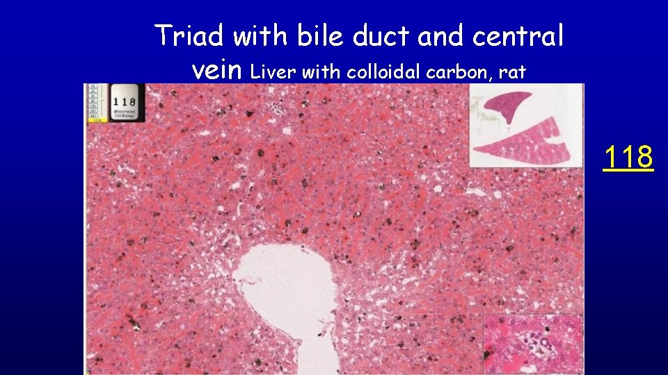 Triad with bile duct and central vein Liver with colloidal carbon, rat 118 