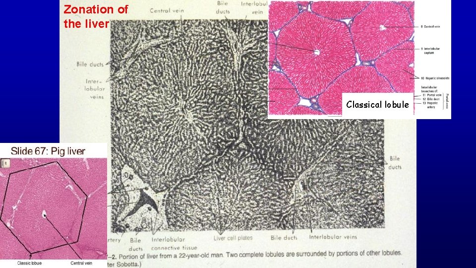 Zonation of the liver Classical lobule 