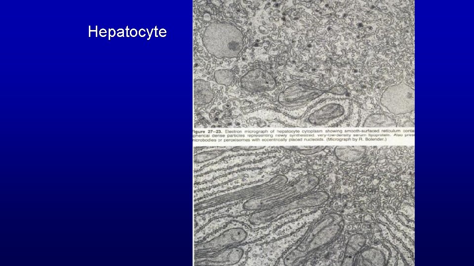 Hepatocyte 