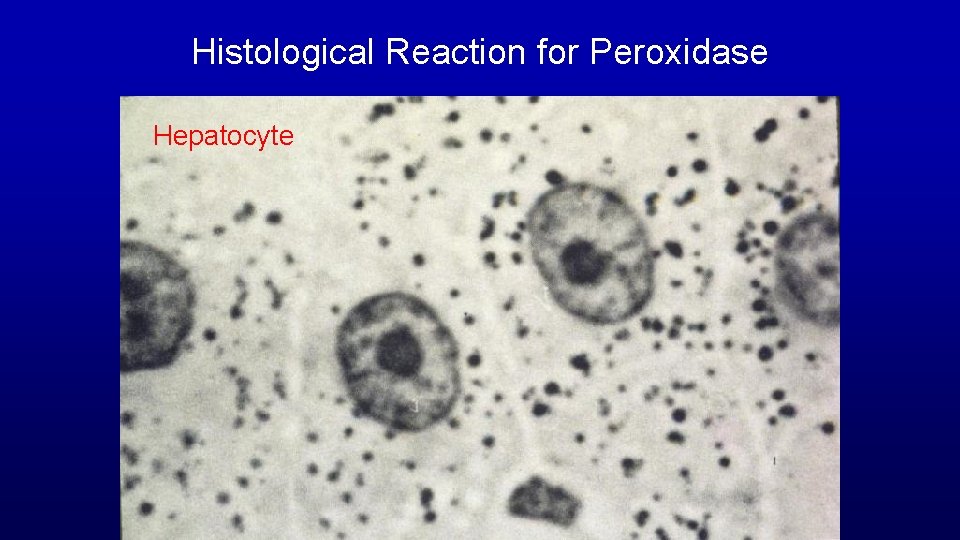 Histological Reaction for Peroxidase Hepatocyte 