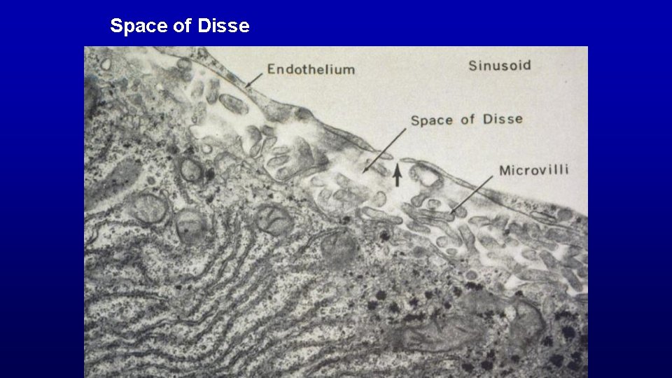 Space of Disse 