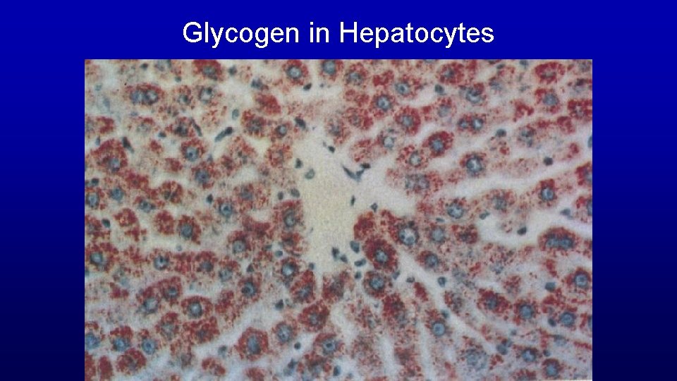 Glycogen in Hepatocytes 