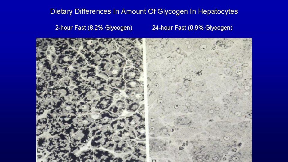 Dietary Differences In Amount Of Glycogen In Hepatocytes 2 -hour Fast (8. 2% Glycogen)