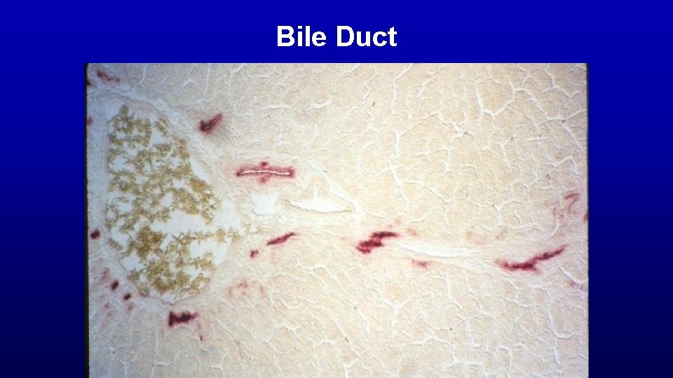 Bile Duct 