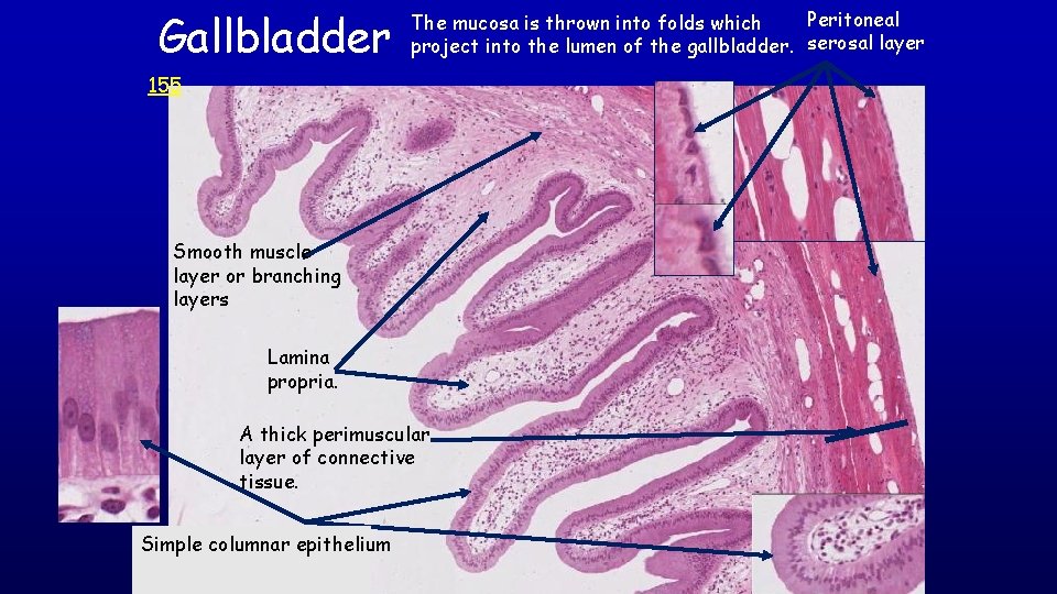 Gallbladder Peritoneal The mucosa is thrown into folds which project into the lumen of