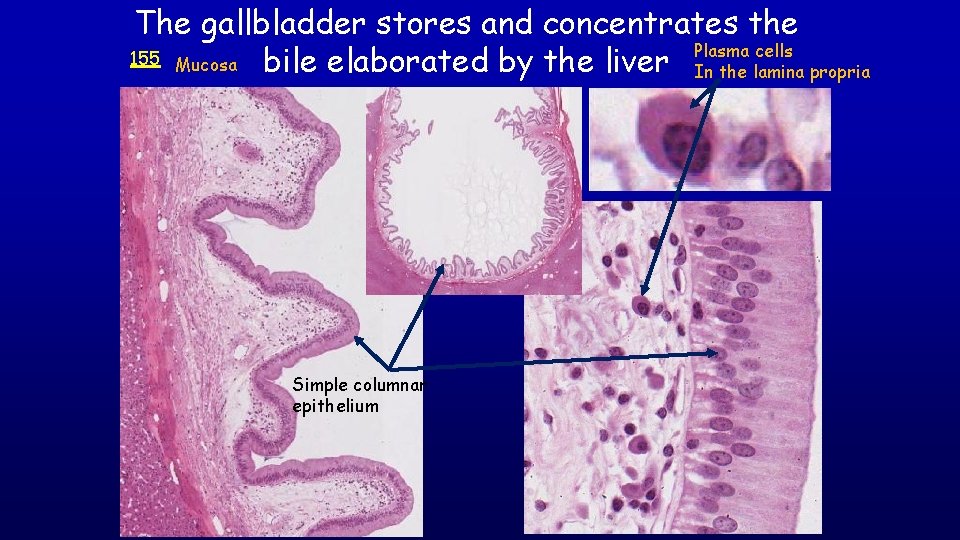 The gallbladder stores and concentrates the 155 Mucosa bile elaborated by the liver Plasma