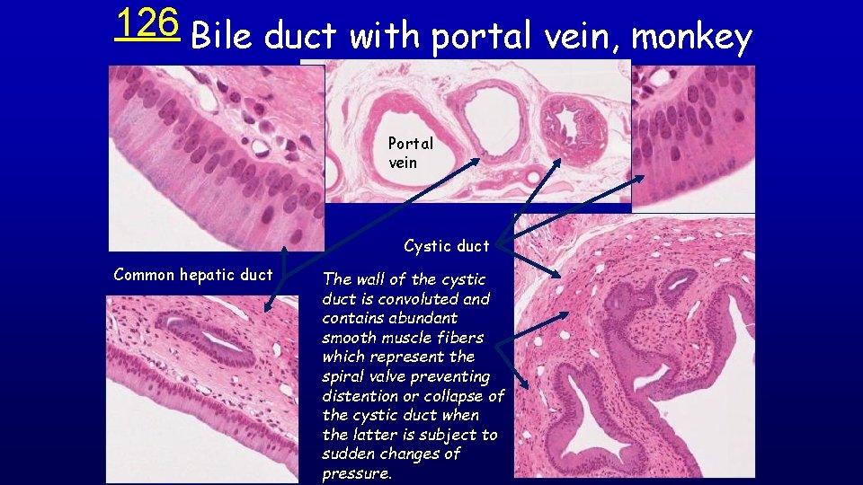 126 Bile duct with portal vein, monkey Portal vein Cystic duct Common hepatic duct