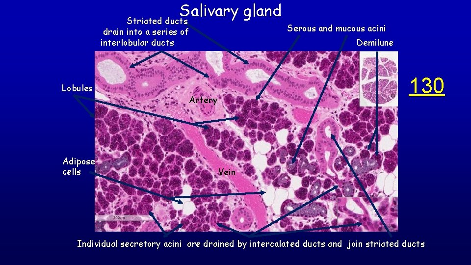 Salivary gland Striated ducts drain into a series of interlobular ducts Lobules Adipose cells