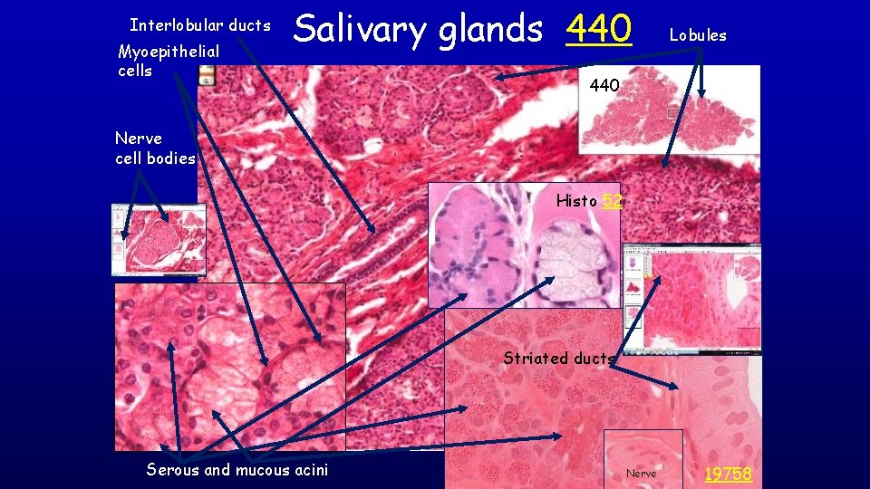 Interlobular ducts Myoepithelial cells Salivary glands 440 Lobules 440 Nerve cell bodies Histo 52