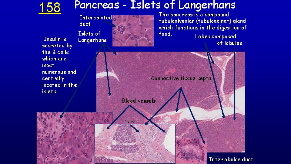 158 Pancreas - Islets of Langerhans Insulin is secreted by the B cells which