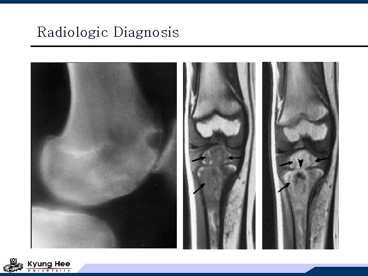 Radiologic Diagnosis 