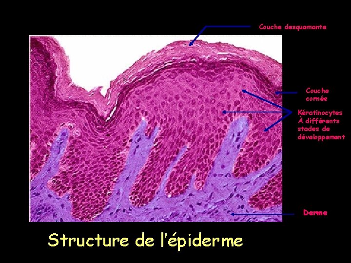 Couche desquamante Couche cornée Kératinocytes À différents stades de développement Derme Structure de l’épiderme