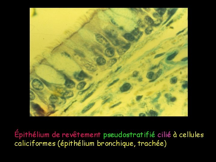 Épithélium de revêtement pseudostratifié cilié à cellules caliciformes (épithélium bronchique, trachée) 