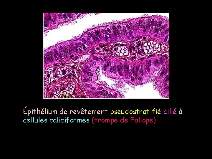 Épithélium de revêtement pseudostratifié cilié à cellules caliciformes (trompe de Fallope) 