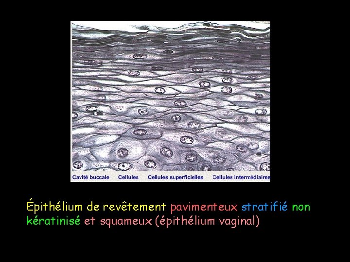 Épithélium de revêtement pavimenteux stratifié non kératinisé et squameux (épithélium vaginal) 