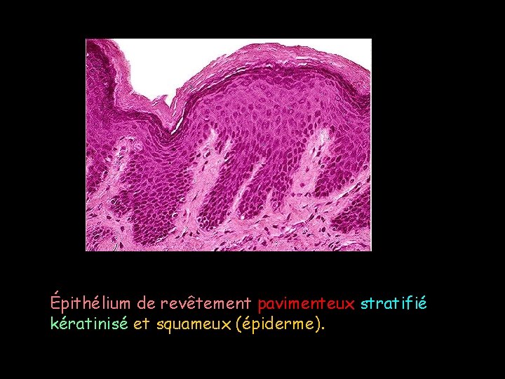 Épithélium de revêtement pavimenteux stratifié kératinisé et squameux (épiderme). 