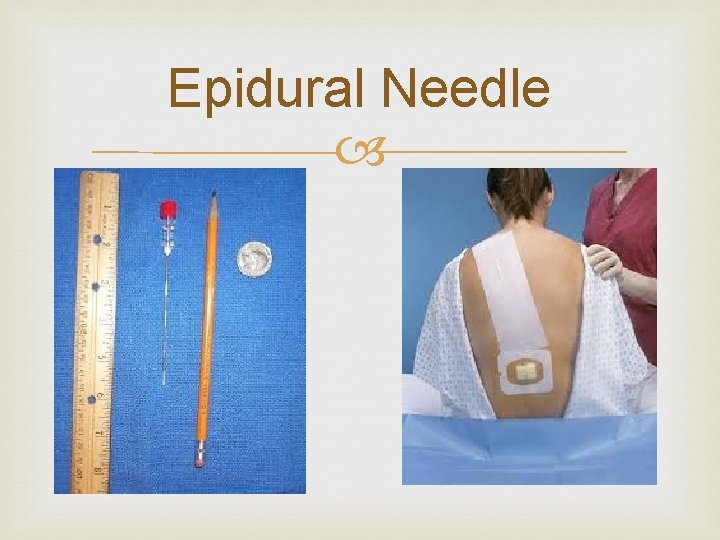 Epidural Needle 