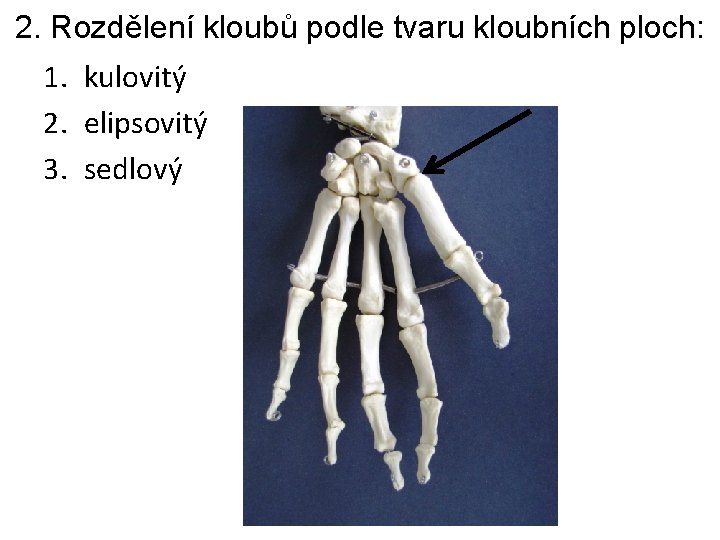 2. Rozdělení kloubů podle tvaru kloubních ploch: 1. kulovitý 2. elipsovitý 3. sedlový 